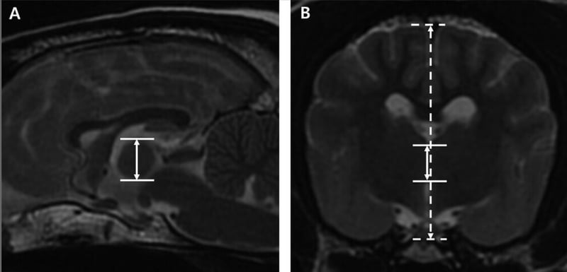 New MRI Metric Offers Reliable Measure of Brain Atrophy in Dogs Across Breeds