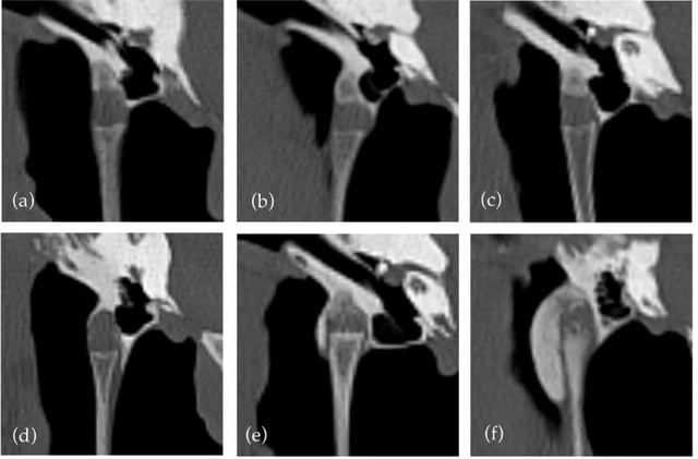 CT Clues in Equine Headshaking? New Study Reveals What Really Matters