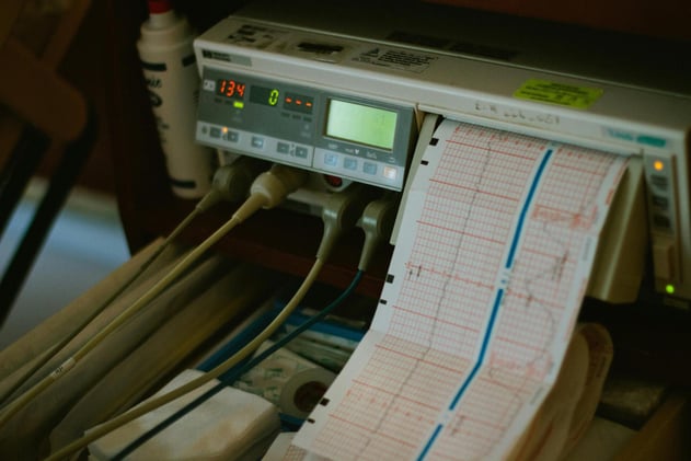 AI knows what's in your heart — and if it will kill you