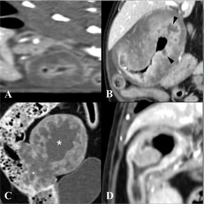 New Imaging Insights: CT & Ultrasound Patterns That Distinguish FGESF in Cats