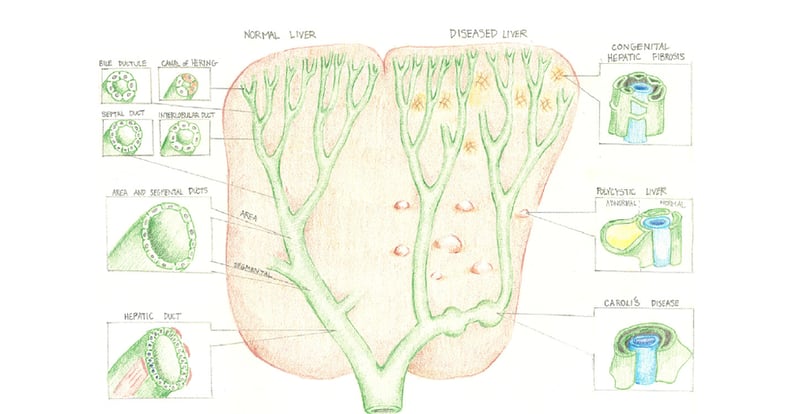 Review your liver congenital anomalies....