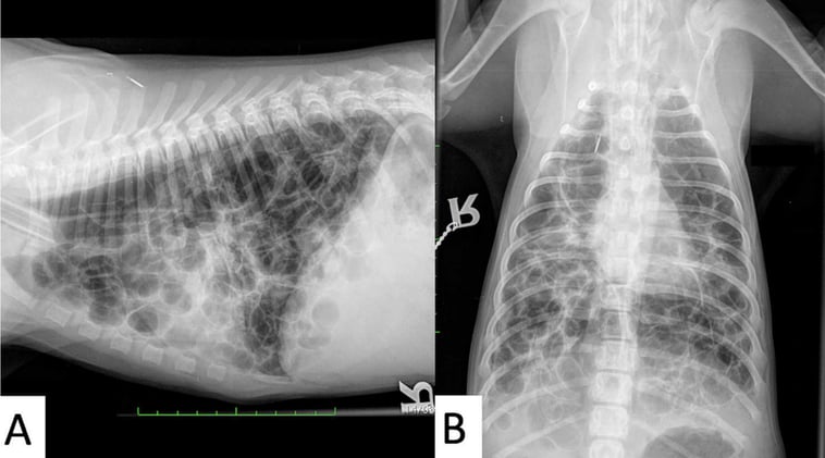 Rads, CT and Histo! Documentation of a severe CPE case.