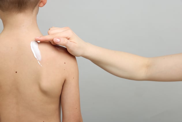 Kortison richtig anwenden