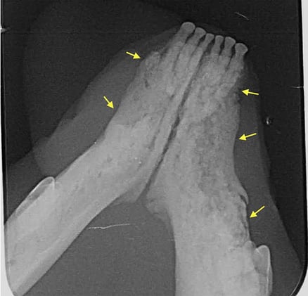 Just be aware of this side effects....