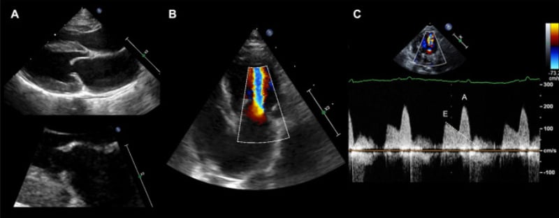New Insights Into Mitral Valve Disease: Study Reveals Acquired Stenosis in Older Cats