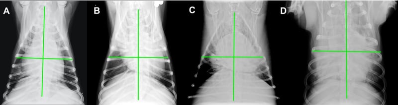 Can you help clinician predict survival from acute pancreatitis?