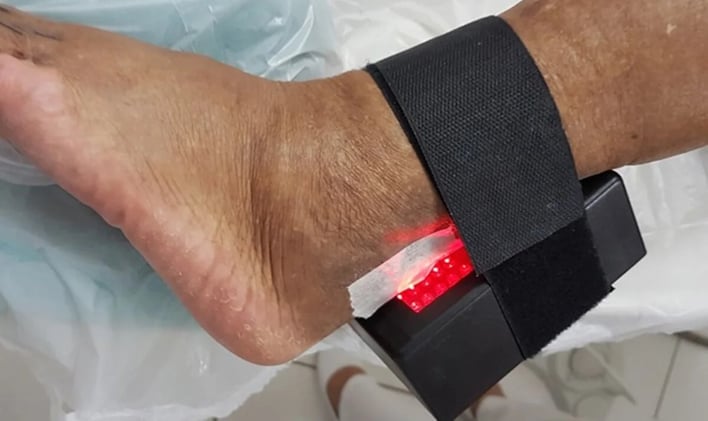 Aparelho anti-amputação