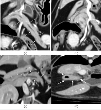 New CT Reference Standards for Feline Pancreatic Ducts Established in 78 Healthy Cats