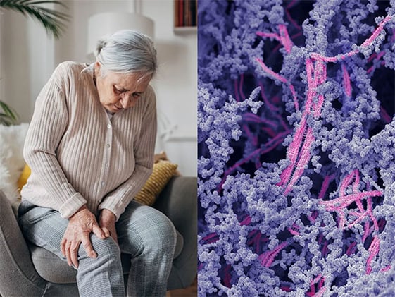 Goo news for your knees