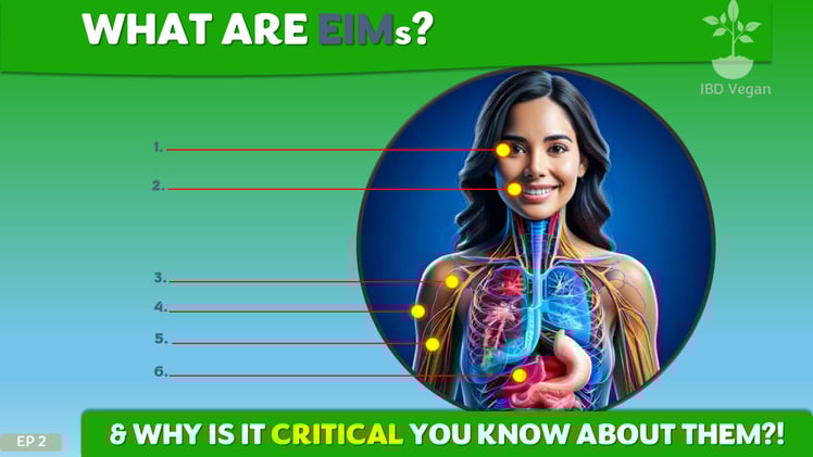 What are EIMs? |  Ep 002