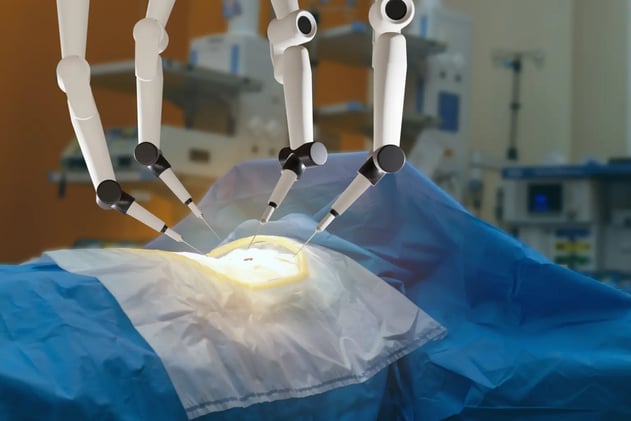 AI Surgeon Nails Perfect Score in Gallbladder Ops 🤖