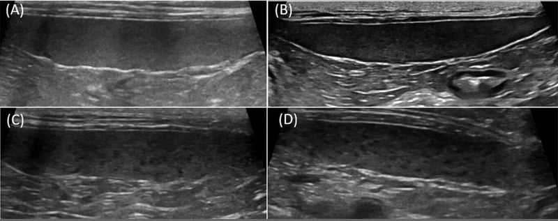 Is a “Mottled” Kitten Spleen Normal? New Evidence from High-Frequency Ultrasound
