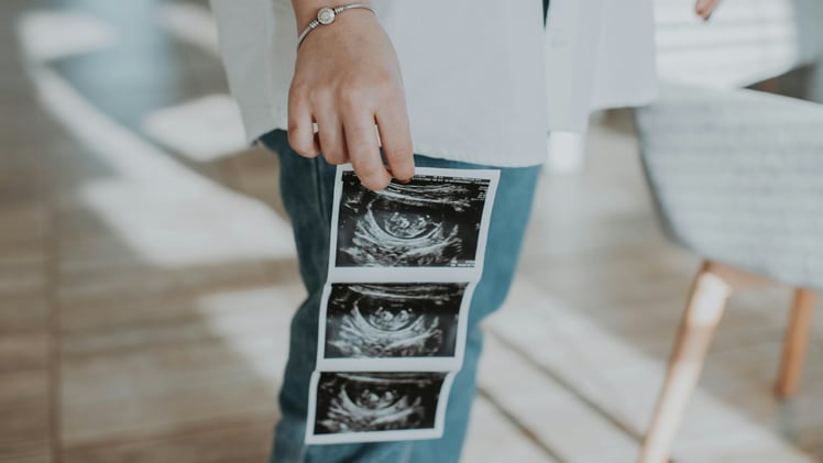 Indiana Court's Abortion Ruling Sparks Outrage