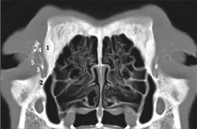 Fast, Simple, and Successful: A Minimally Invasive Fix for Canine Dacryocystitis