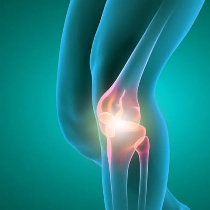 5 Exercises to Overcome Osteoarthritis Pain and Restore Function