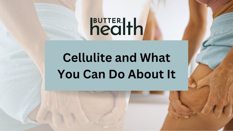Cellulite and What Can You Do About It