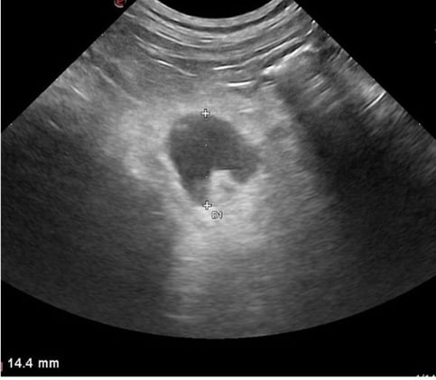 Fulminant Clostridial Infections in Cats: Two Cases That Redefine Feline Intra-Abdominal Sepsis