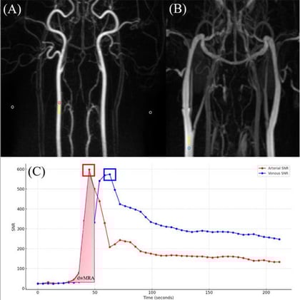 Optimizing Canine MRA: Slower Contrast Injection Improves Imaging Clarity and Reduces Artifacts
