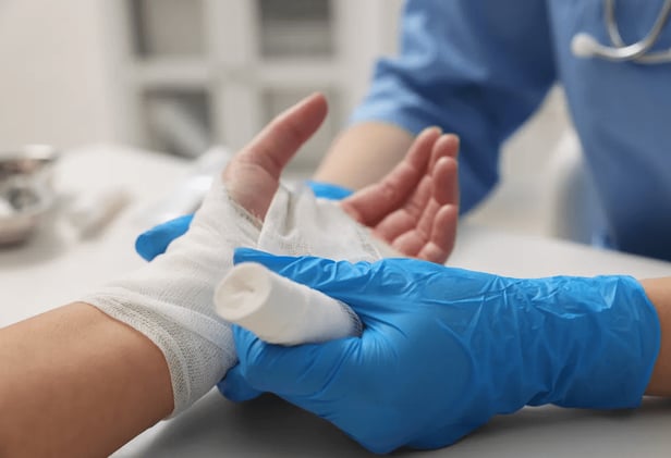 How Silvadene Cream Heals Burns and Wounds