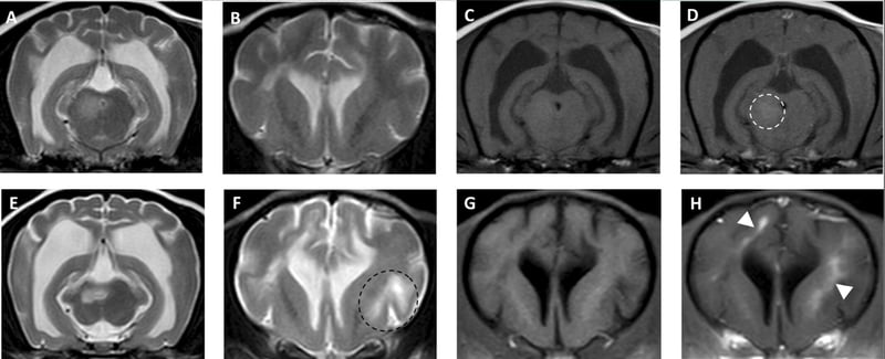 Should we repeat MRI in MUE cases?