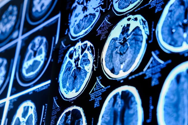 🩺 Wait... adolescence lasts until 32?