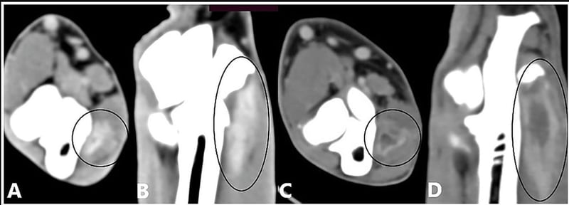 Are We Missing Elbow Pathology in Dogs? What Contrast-Enhanced CT Reveals