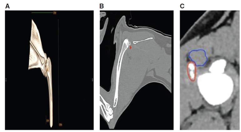 When Rest Isn’t Enough: CT-Guided Surgery Resolves Rare Infraspinatus Ossification in Dog