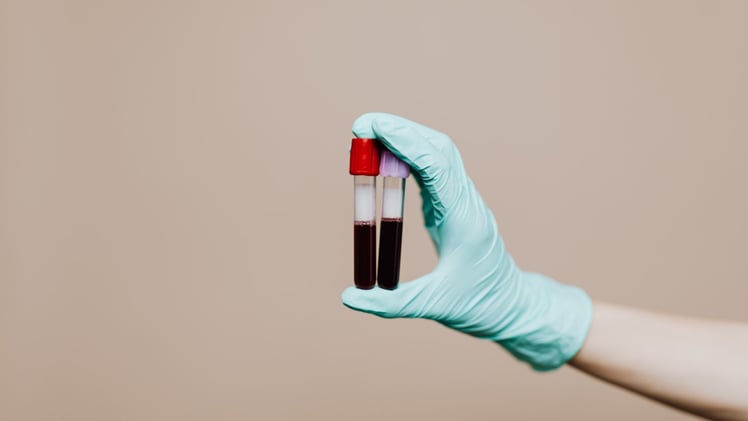 Lipoprotein(a): Der vergessene Risikomarker für dein Herz