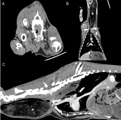 Cool VRU case report