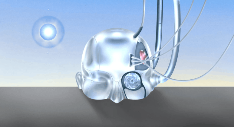 AI could soon improve on its own