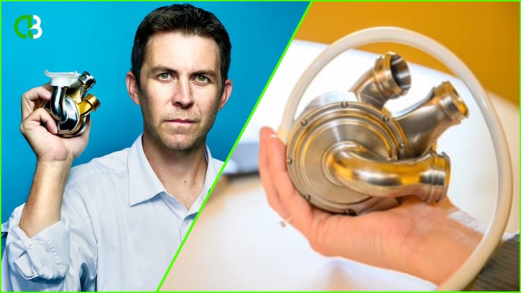 Man survives with Titanium heart