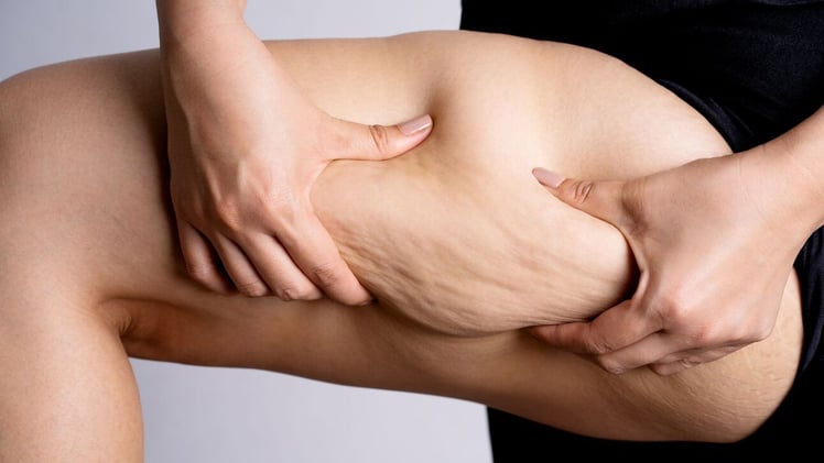 8 Secrets to Get Rid of Cellulite and Thigh Fat Fast!