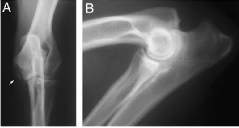 Is Un-United Medial Epicondyle Really Part of Elbow Dysplasia? A 15% Prevalence Study in Labradors