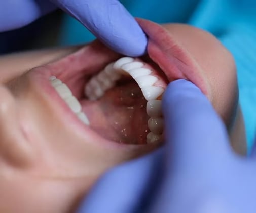 Neglecting Teeth? It Could Hurt Your Heart